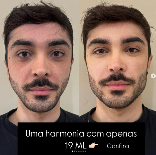 19ml.png