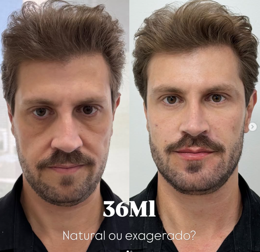 36ml2