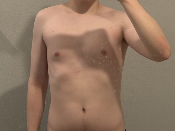 IMG 1761