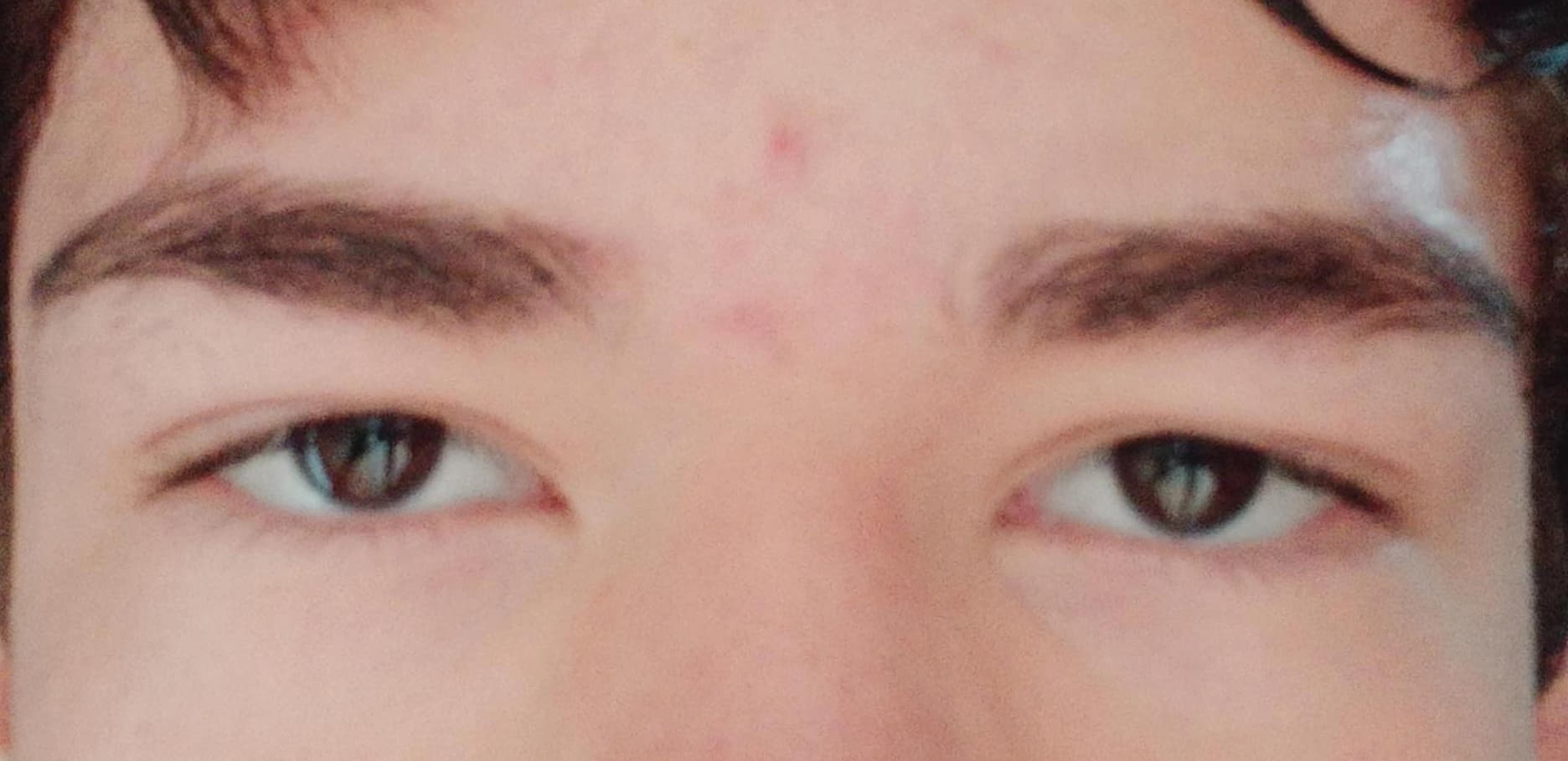 1000077517