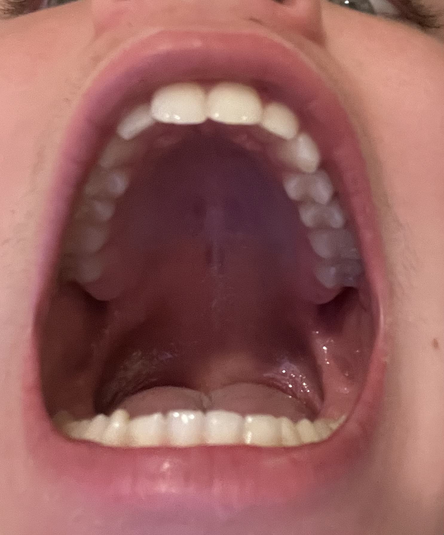 IMG 1403