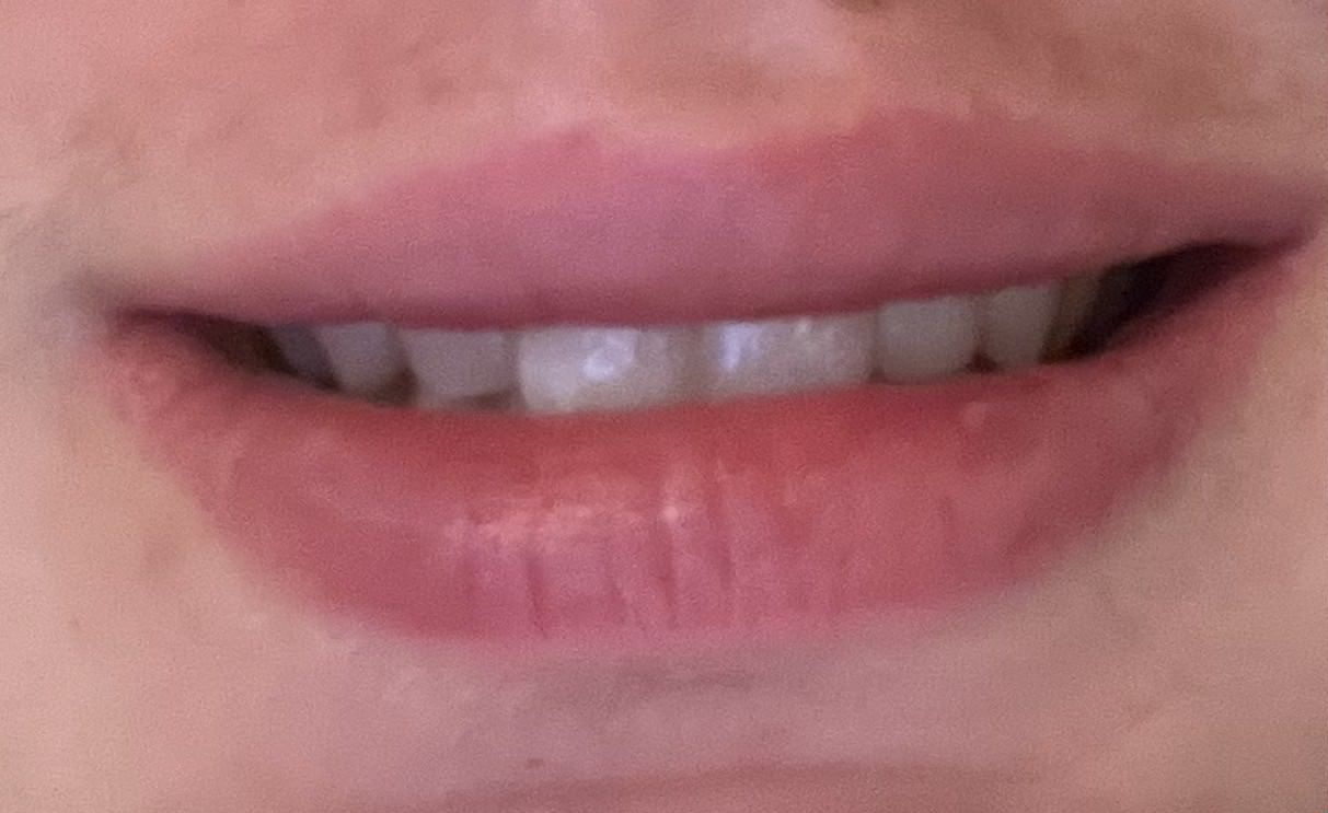 IMG 1400