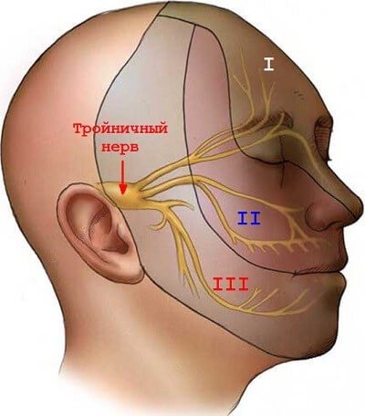 Nevralgiya trojnichnogo nerva