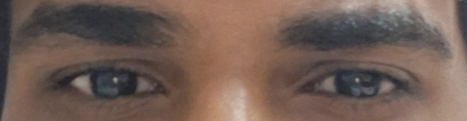 1000148483