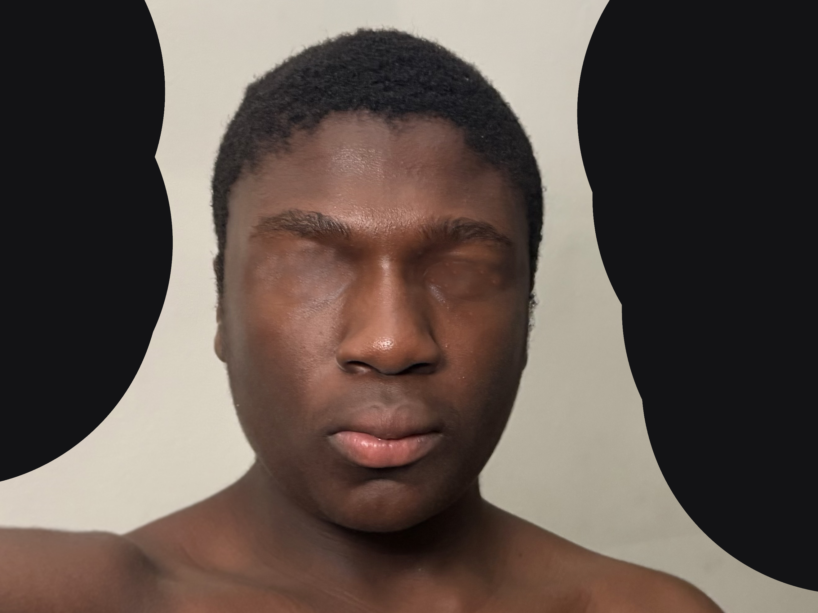 RATE