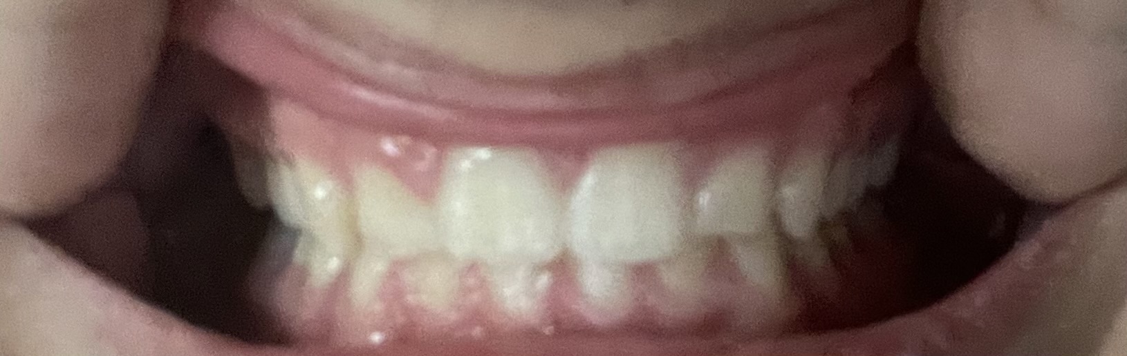 IMG 3350
