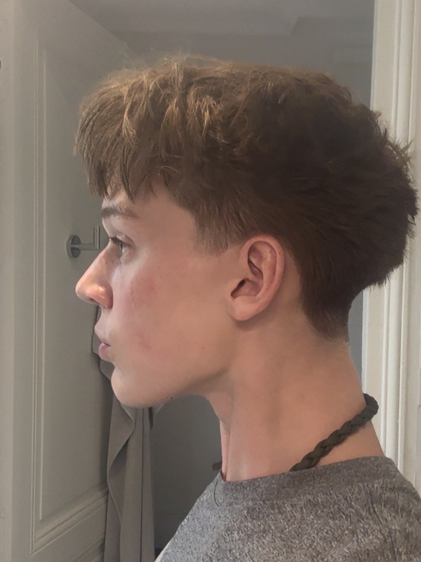 IMG 2666