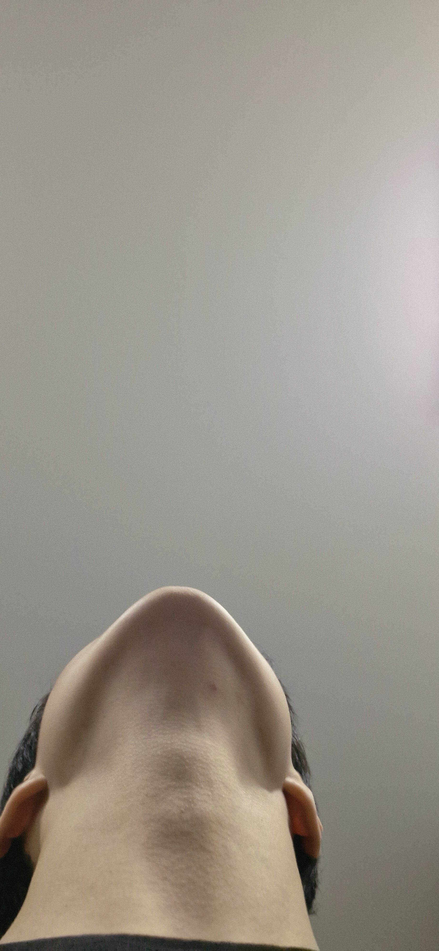 1000072236