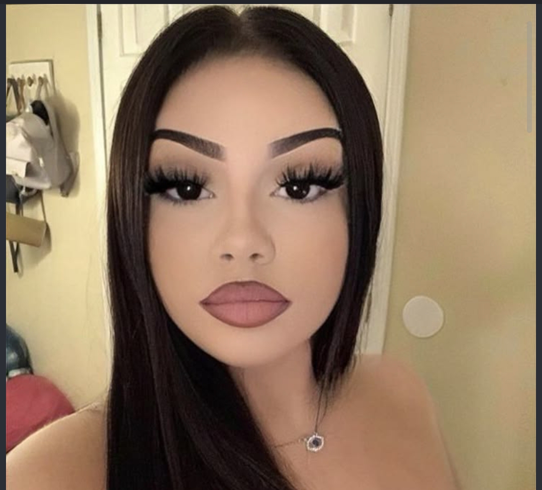 1000028076