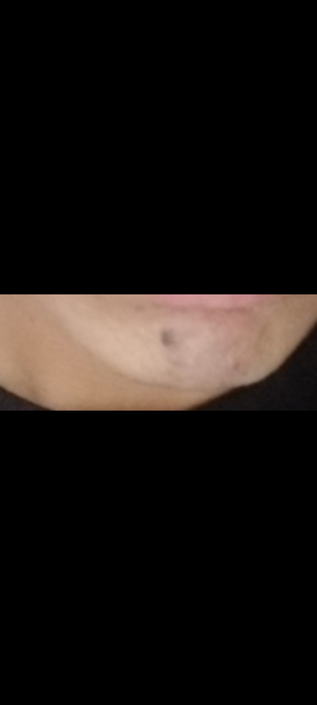 1000053379