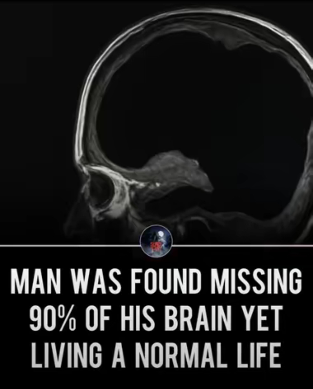1000017947