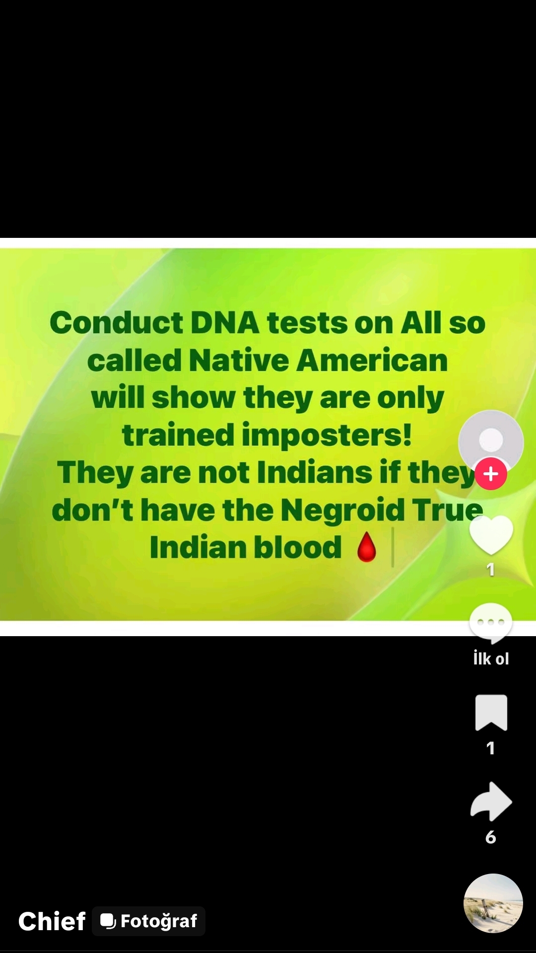 1000035645