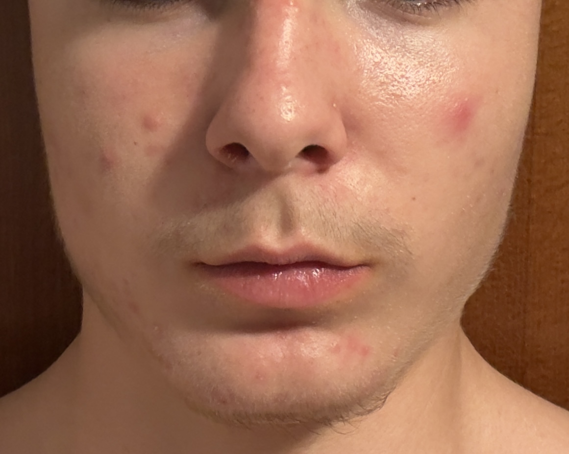 IMG 0276