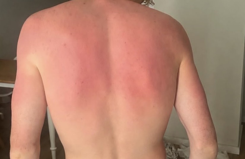 IMG 0674