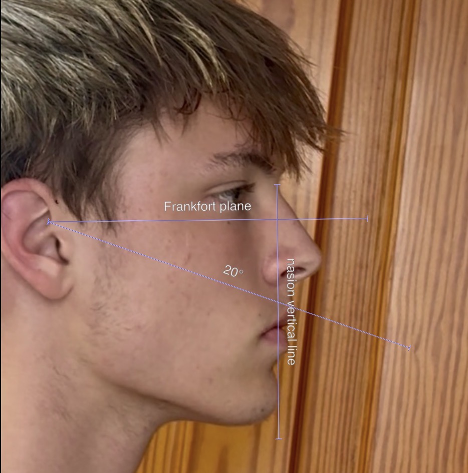 IMG 0818