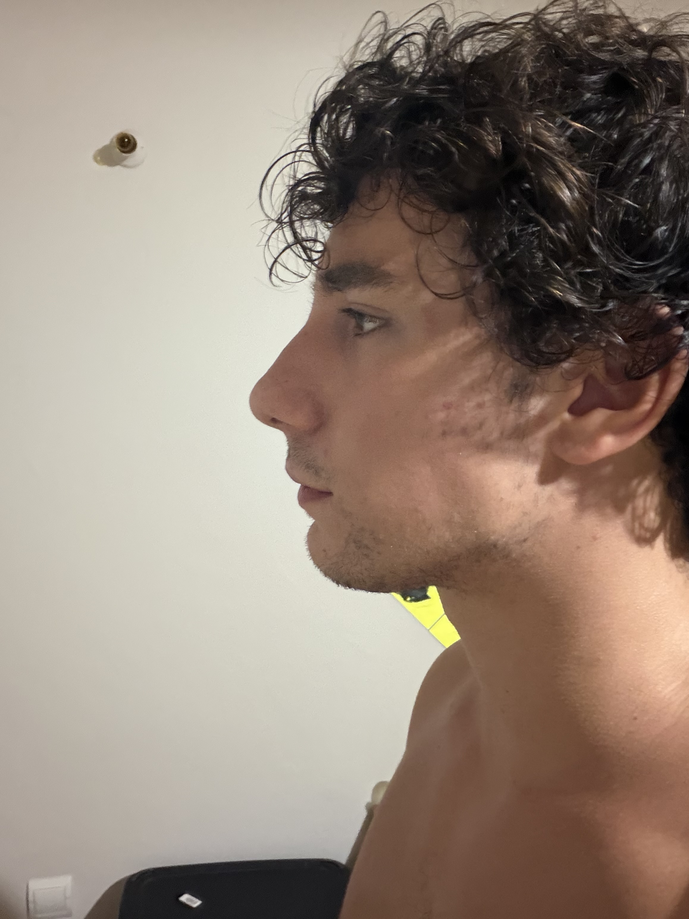 IMG 2632