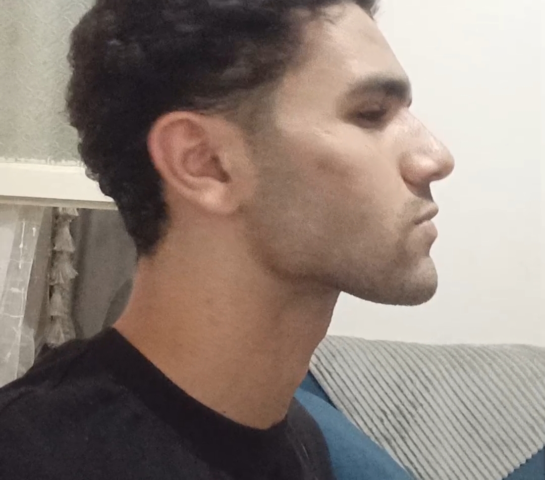 1000230037