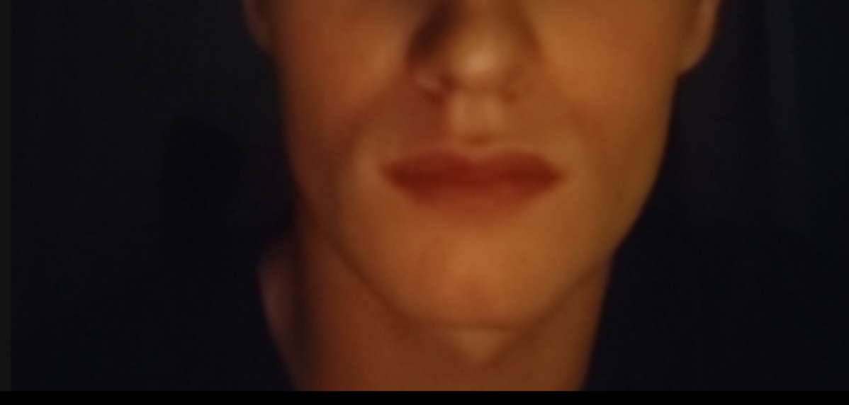 1000026623