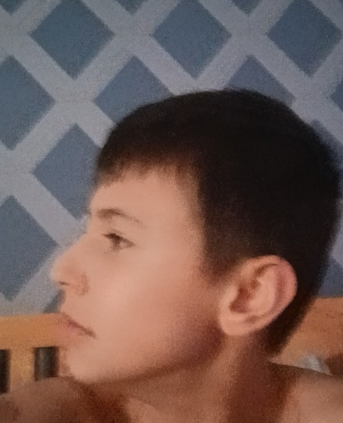1000015321