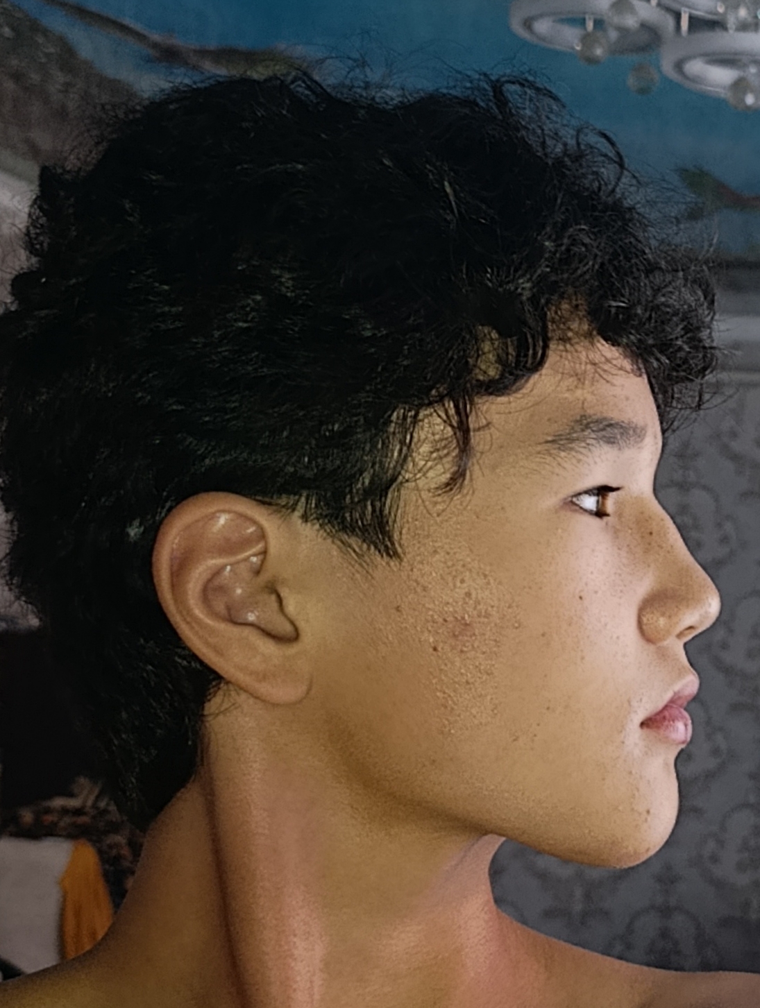 1000016517