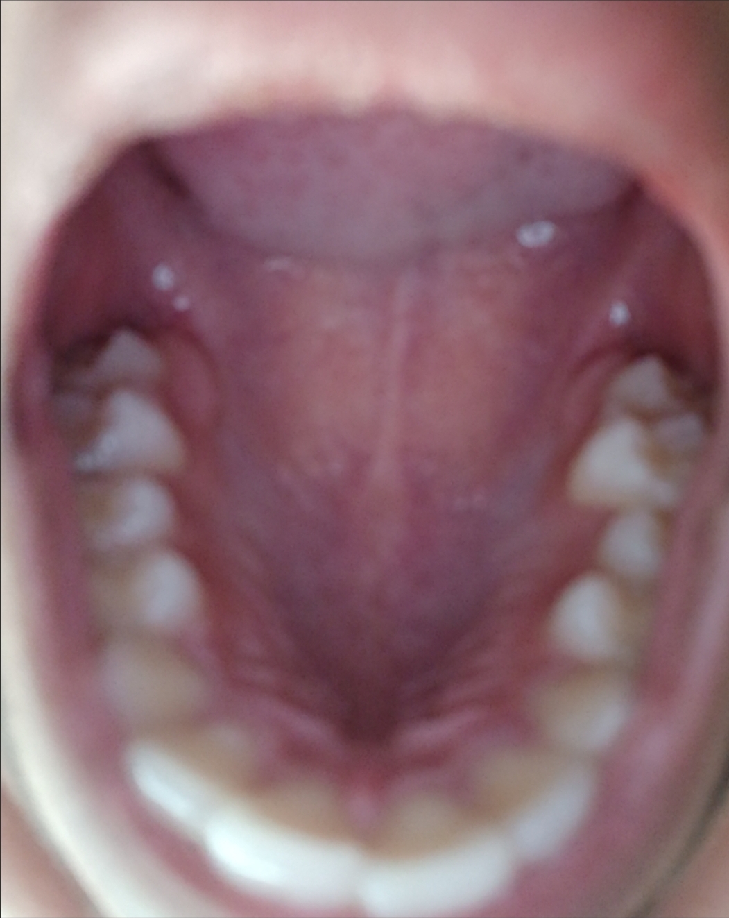 48