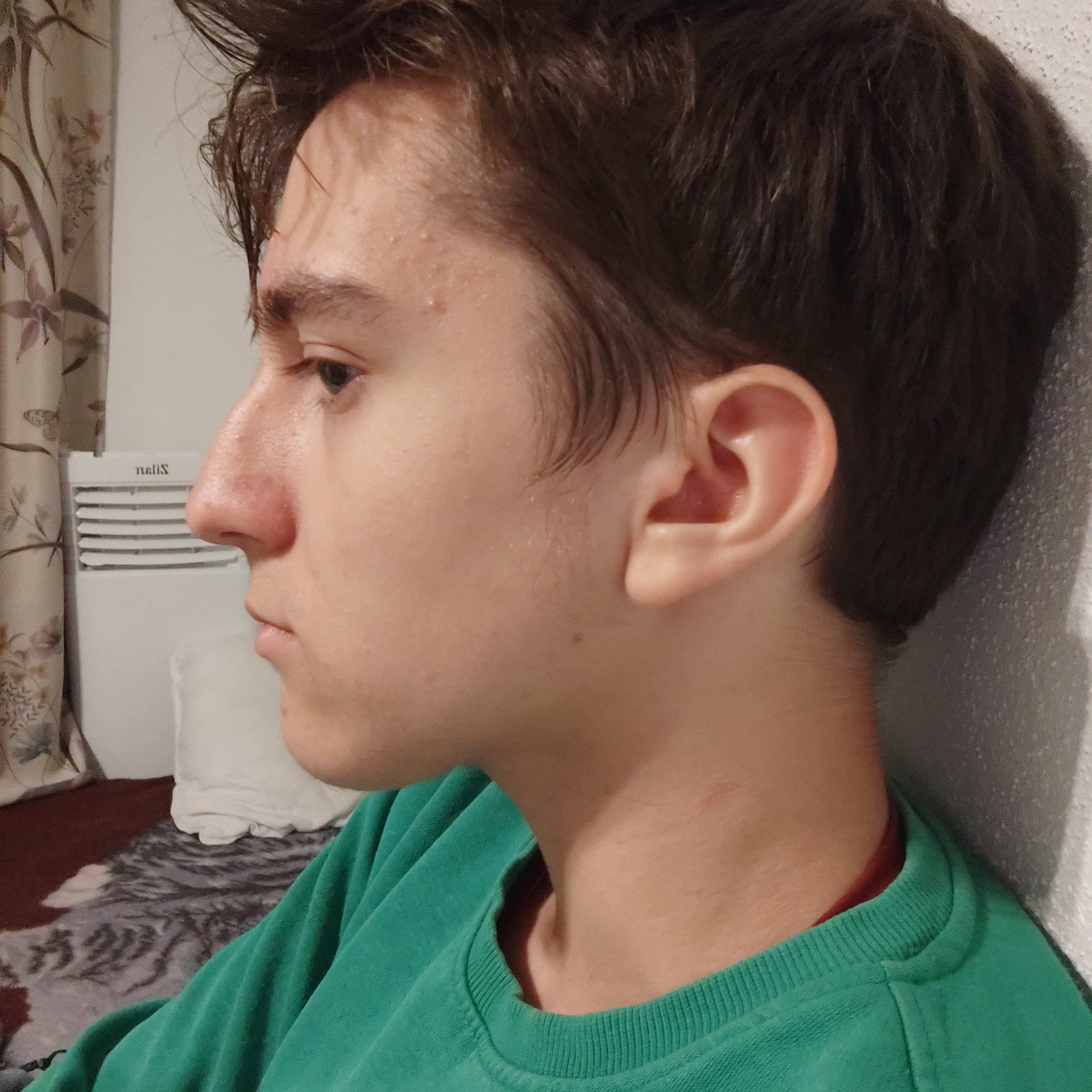 1000104525