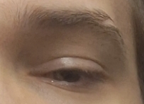 1000009484
