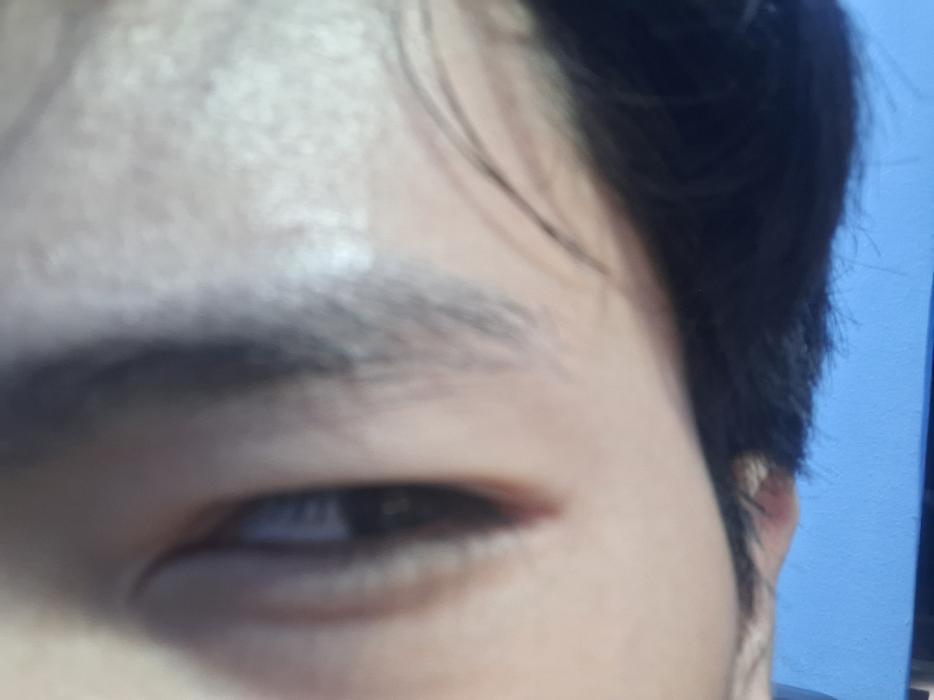 1000057992