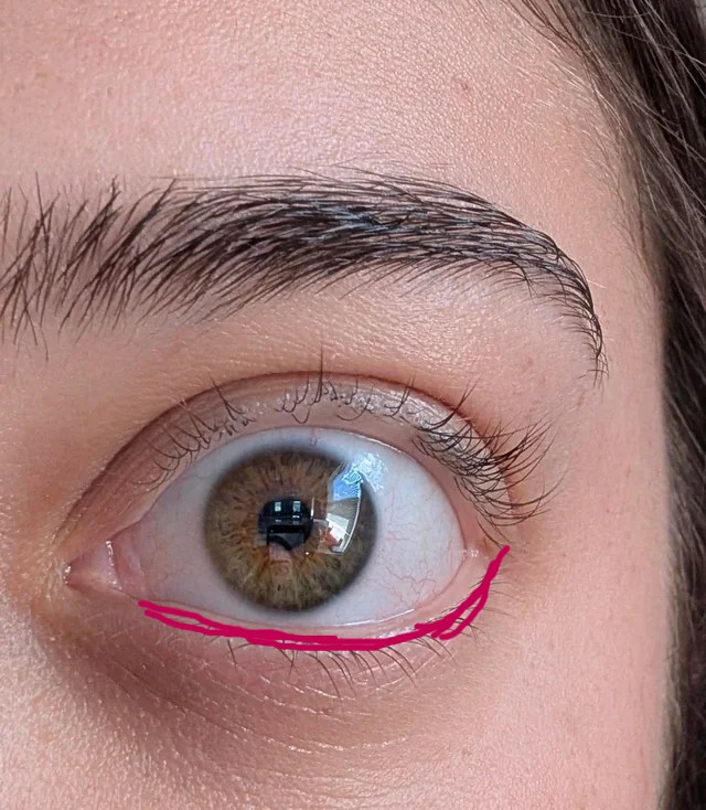 Eyelashes fell out v0 ix0rs3qry8ch1