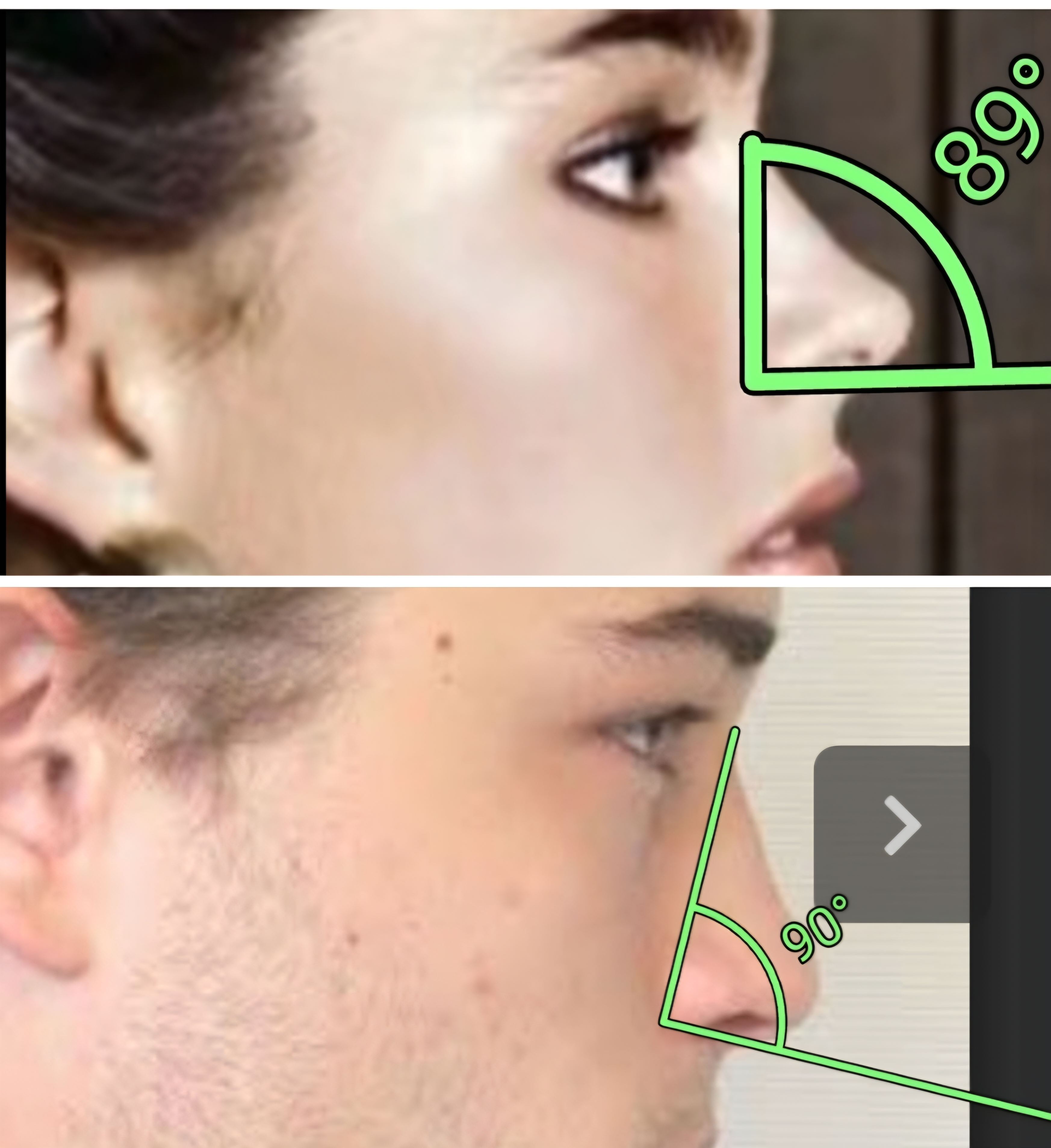 1000030398