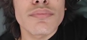 1000041523