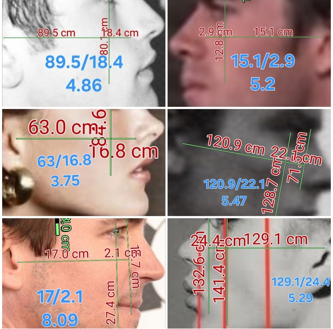 1000030423