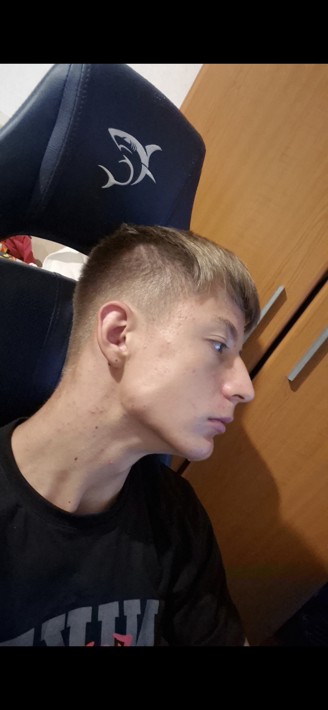 1000018215