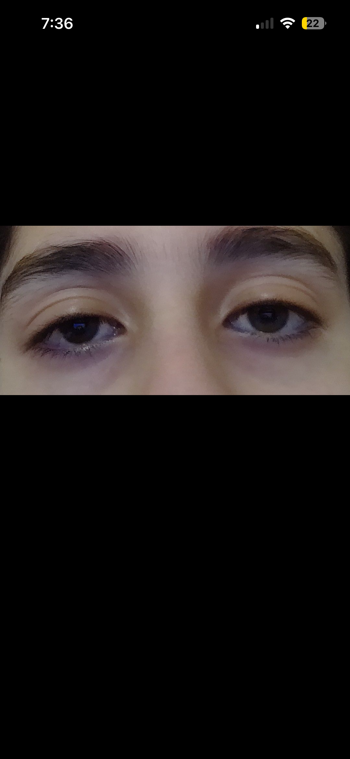 Eyes