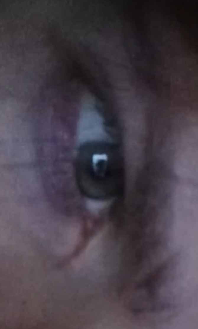 1000008194