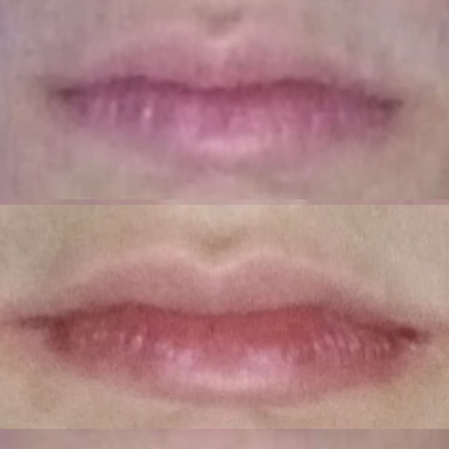 Before and after