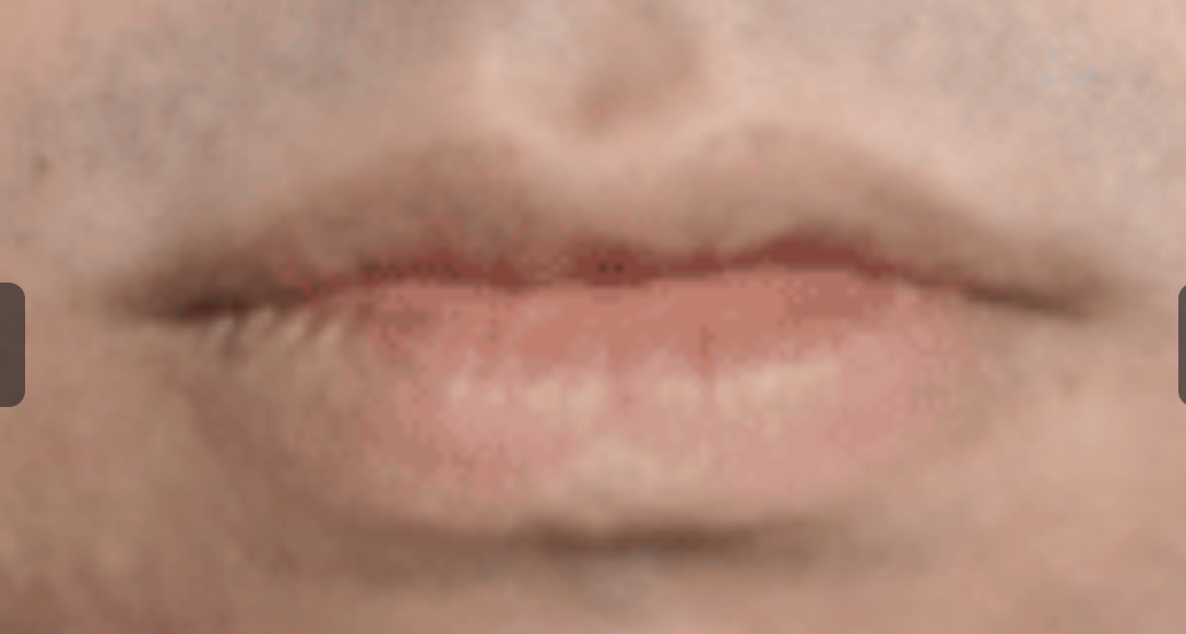 IMG 1336