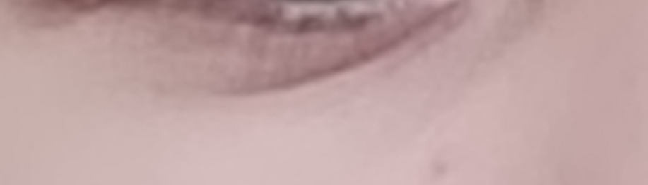 1000032300