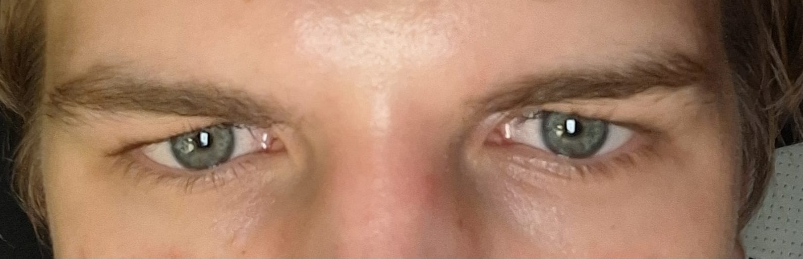 Eye