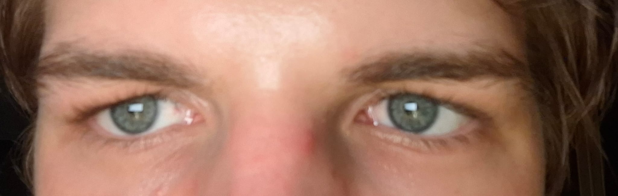 Eyes