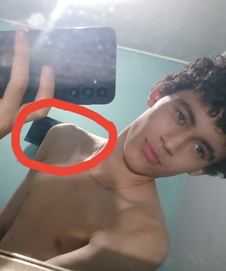 1000049423