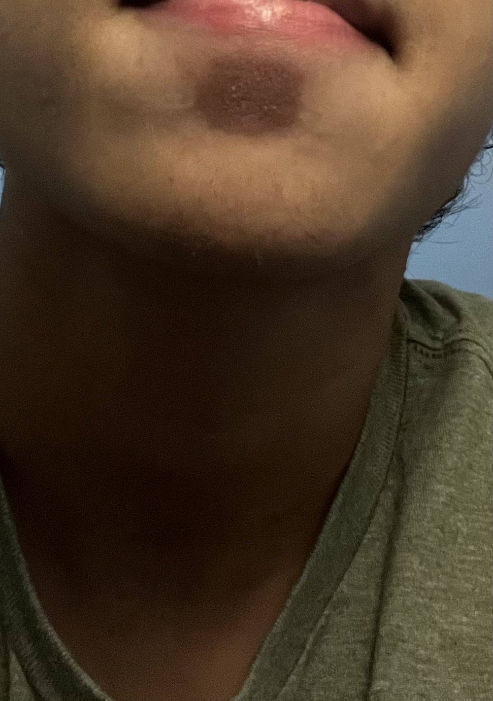 IMG 0492