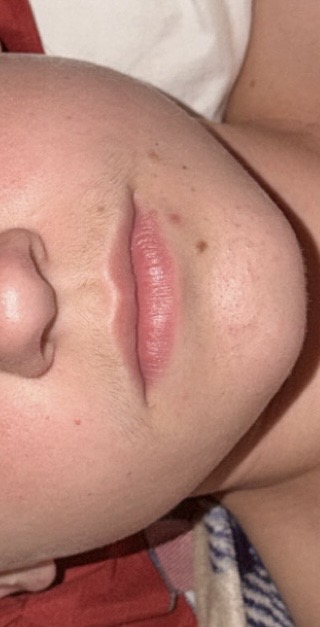 IMG 0476