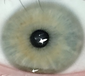 1000015178