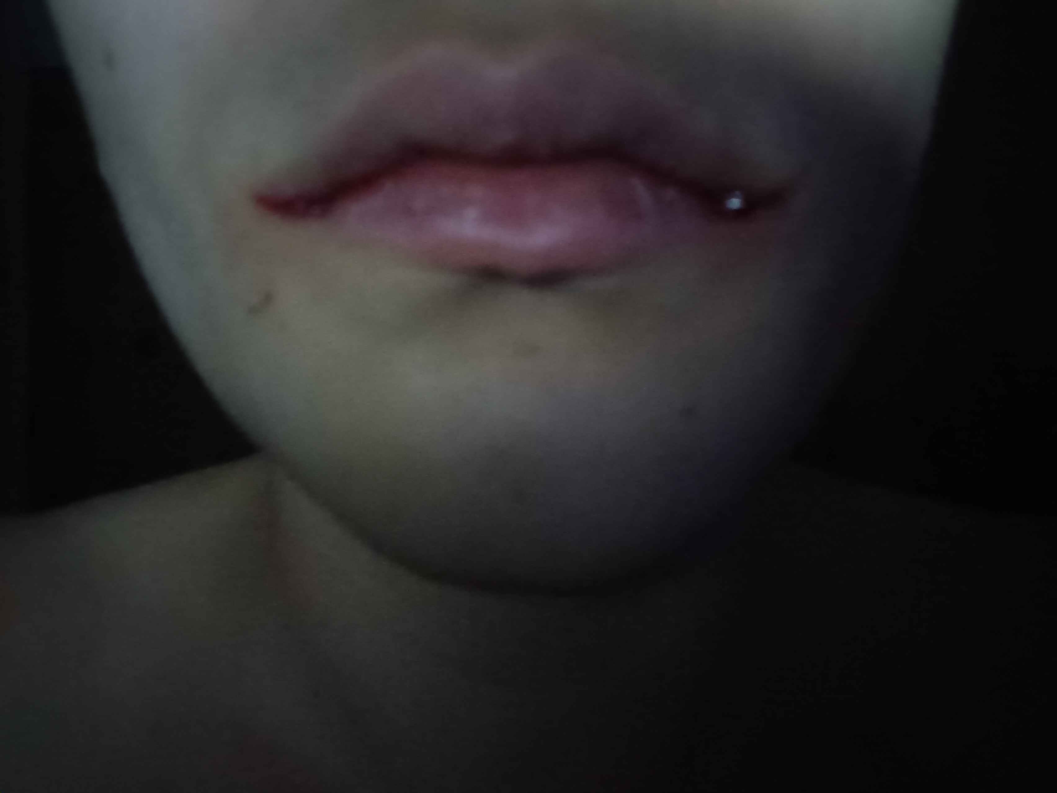 Lips after
