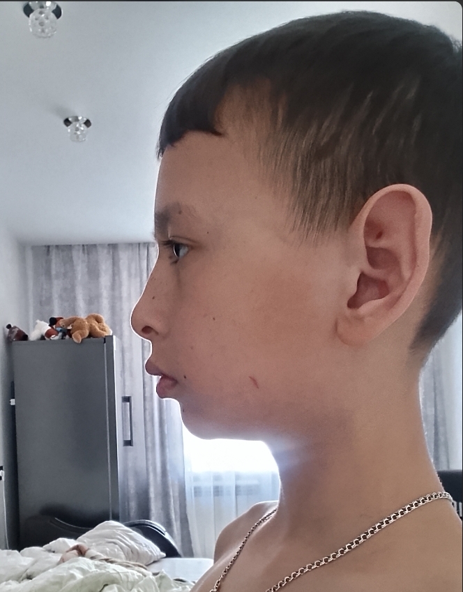 1000057082