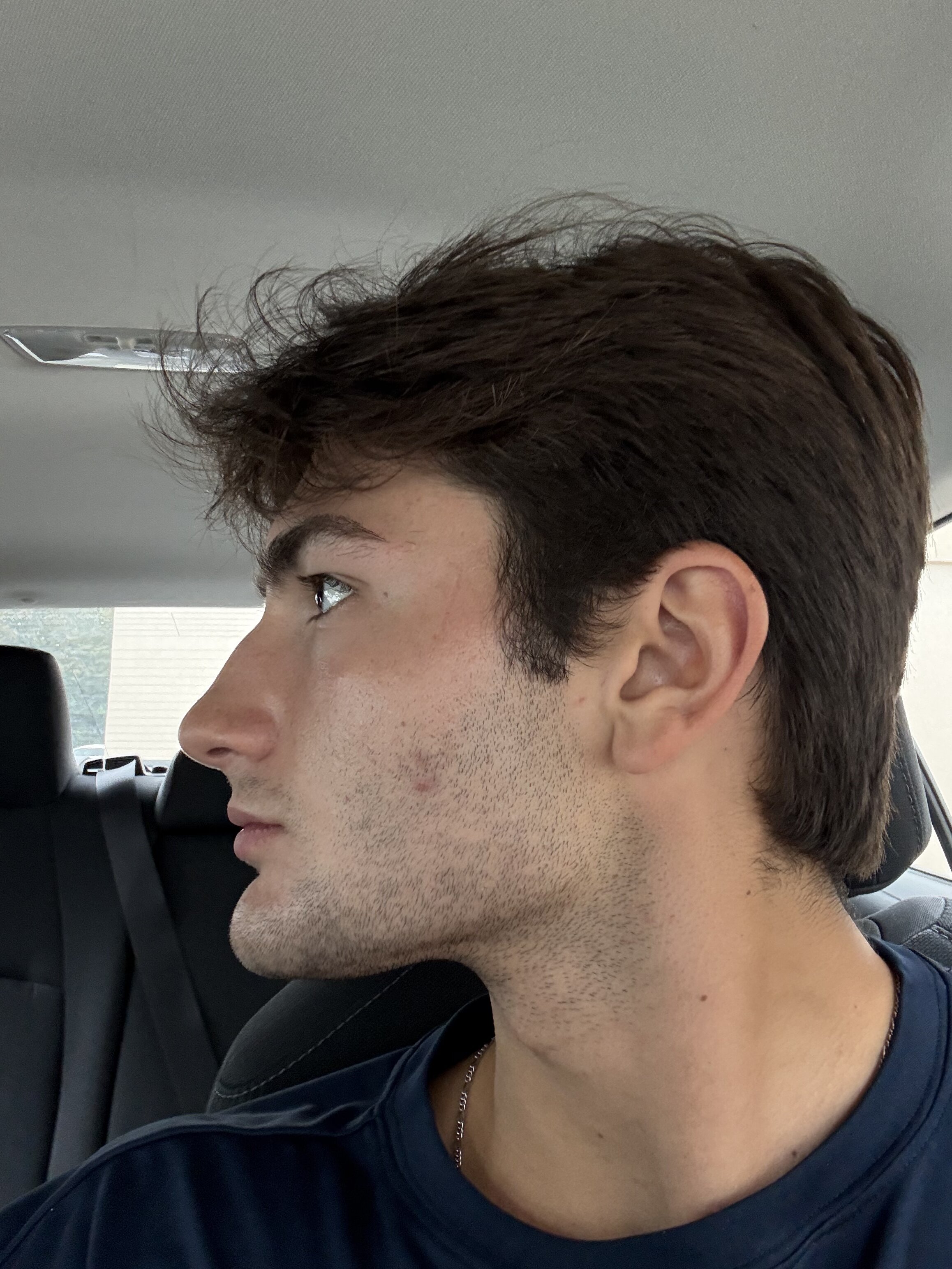 IMG 0678