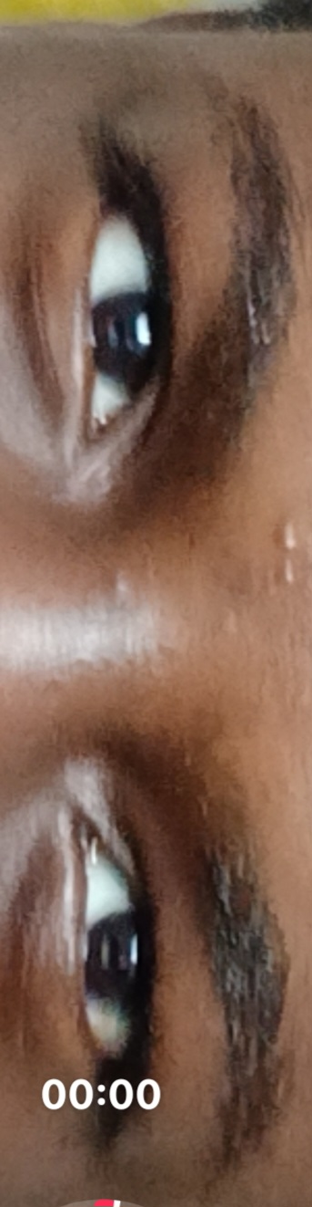1000088475