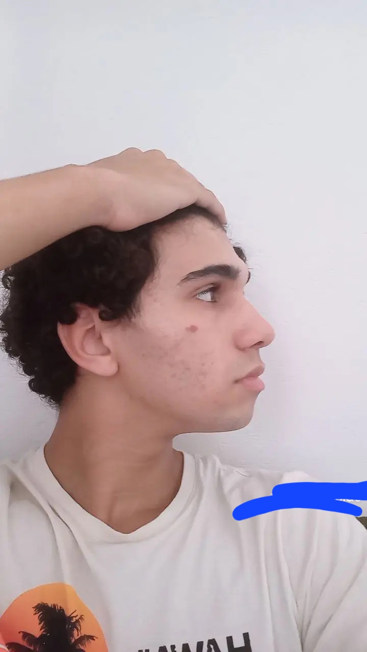 1000001421