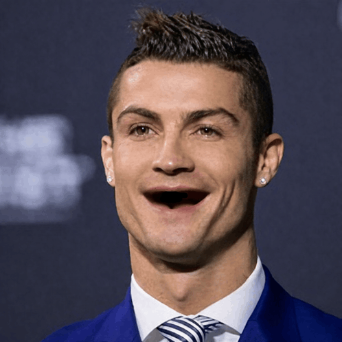 Ronaldo with one teeth funny